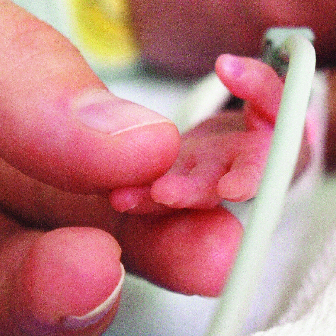 Image of premature baby and adult's hand