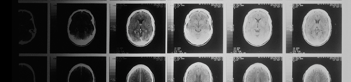 image of a brain scan